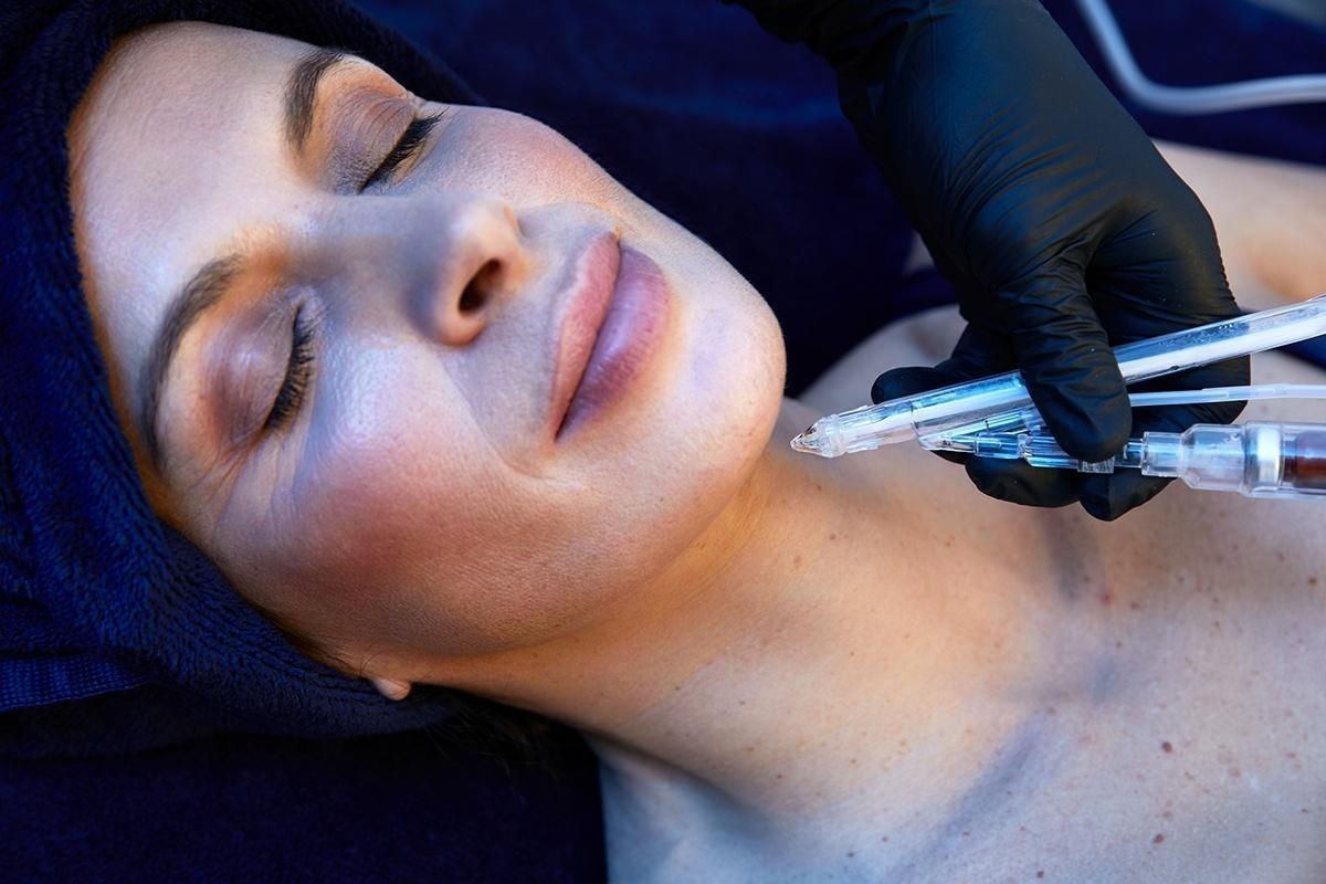 Soin innovant réalisé dans les centres Thetys, le JetPeel donne un coup de jeune à la peau.© Sylvain Renault Image